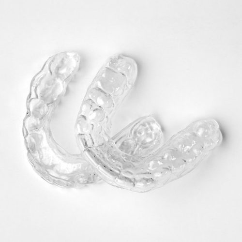 aligner
