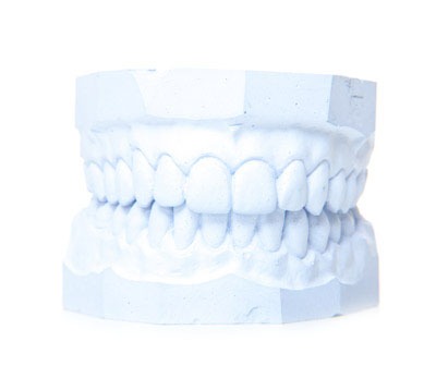 dental model