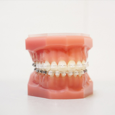 braces