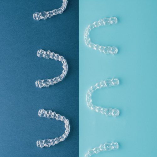 Aligner